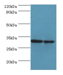 PNP / Nucleoside Phosphorylase Antibody - Western blot. All lanes: PNP antibody at 6 ug/ml. Lane 1: Jurkat whole cell lysate. Lane 2: k562 whole cell lysate. Secondary antibody: Goat polyclonal to rabbit at 1:10000 dilution. Predicted band size: 32 kDa. Observed band size: 32 kDa.