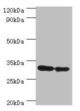 PNP / Nucleoside Phosphorylase Antibody - Western blot All lanes: PNP antibody at 6µg/ml Lane 1: Jurkat whole cell lysate Lane 2: k562 whole cell lysate Secondary Goat polyclonal to rabbit IgG at 1/10000 dilution Predicted band size: 32 kDa Observed band size: 32 kDa