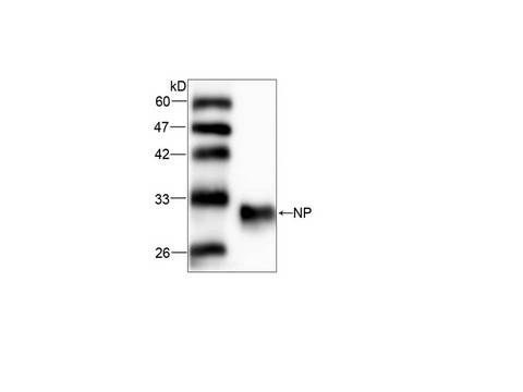 PNP / Nucleoside Phosphorylase Antibody - WB analysis of NP expression in HEK293 whole cell lysate with PNP / Nucleoside Phosphorylase Antibody (1:1000).