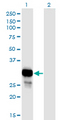 PNP / Nucleoside Phosphorylase Antibody - Western Blot analysis of NP expression in transfected 293T cell line by NP monoclonal antibody (M01), clone 6E5.Lane 1: NP transfected lysate (Predicted MW: 32.1 KDa).Lane 2: Non-transfected lysate.