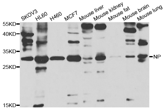 PNP / Nucleoside Phosphorylase Antibody - Western blot analysis of extracts of various cell lines.