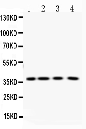 PNP / Nucleoside Phosphorylase Antibody - Western blot analysis of PNP using anti-PNP antibody. Electrophoresis was performed on a 5-20% SDS-PAGE gel at 70V (Stacking gel) / 90V (Resolving gel) for 2-3 hours. The sample well of each lane was loaded with 50ug of sample under reducing conditions. Lane 1: rat thymus tissue lysates,Lane 2: rat ovary tissue lysates,Lane 3: mouse liver tissue lysates,Lane 4: human placneta tissue lysates. After Electrophoresis, proteins were transferred to a Nitrocellulose membrane at 150mA for 50-90 minutes. Blocked the membrane with 5% Non-fat Milk/ TBS for 1.5 hour at RT. The membrane was incubated with rabbit anti-PNP antigen affinity purified polyclonal antibody at 0.5 µg/mL overnight at 4°C, then washed with TBS-0.1% Tween 3 times with 5 minutes each and probed with a goat anti-rabbit IgG-HRP secondary antibody at a dilution of 1:10000 for 1.5 hour at RT. The signal is developed using an Enhanced Chemiluminescent detection (ECL) kit with Tanon 5200 system. A specific band was detected for PNP at approximately 38KD. The expected band size for PNP is at 38KD.