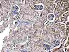 PNP / Nucleoside Phosphorylase Antibody - IHC analysis of PNP using anti-PNP antibody. PNP was detected in paraffin-embedded section of mouse kidney tissues. Heat mediated antigen retrieval was performed in citrate buffer (pH6, epitope retrieval solution) for 20 mins. The tissue section was blocked with 10% goat serum. The tissue section was then incubated with 1µg/ml rabbit anti-PNP Antibody overnight at 4°C. Biotinylated goat anti-rabbit IgG was used as secondary antibody and incubated for 30 minutes at 37°C. The tissue section was developed using Strepavidin-Biotin-Complex (SABC) with DAB as the chromogen.