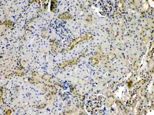 PNP / Nucleoside Phosphorylase Antibody - IHC analysis of PNP using anti-PNP antibody. PNP was detected in paraffin-embedded section of rat kidney tissues. Heat mediated antigen retrieval was performed in citrate buffer (pH6, epitope retrieval solution) for 20 mins. The tissue section was blocked with 10% goat serum. The tissue section was then incubated with 1µg/ml rabbit anti-PNP Antibody overnight at 4°C. Biotinylated goat anti-rabbit IgG was used as secondary antibody and incubated for 30 minutes at 37°C. The tissue section was developed using Strepavidin-Biotin-Complex (SABC) with DAB as the chromogen.