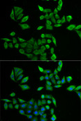 PNP / Nucleoside Phosphorylase Antibody - Immunofluorescence analysis of U2OS cells using PNP antibody. Blue: DAPI for nuclear staining.