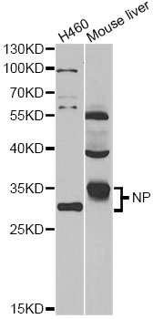 PNP / Nucleoside Phosphorylase Antibody - Western blot analysis of extracts of various cell lines, using PNP antibody at 1:1000 dilution. The secondary antibody used was an HRP Goat Anti-Rabbit IgG (H+L) at 1:10000 dilution. Lysates were loaded 25ug per lane and 3% nonfat dry milk in TBST was used for blocking. An ECL Kit was used for detection and the exposure time was 60s.