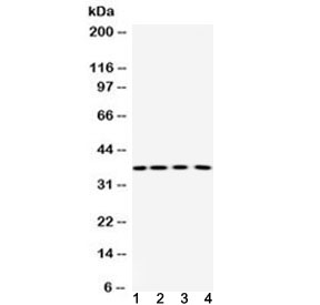PNP / Nucleoside Phosphorylase Antibody - Western blot testing of 1) rat thymus, 2) rat ovary, 3) mouse liver and 4) human placenta lysate using Purine nucleoside phosphorylase antibody at 0.5ug/ml. Predicted molecular weight: 32-34 kDa.