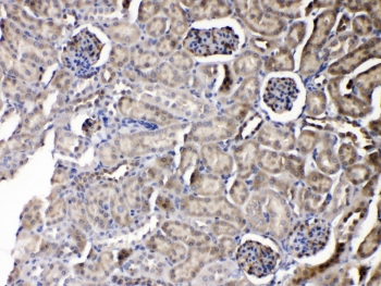 PNP / Nucleoside Phosphorylase Antibody - IHC testing of FFPE mouse kidney tissue with Purine nucleoside phosphorylase antibody at 1ug/ml. HIER: steam section in pH6 citrate buffer for 20 min.