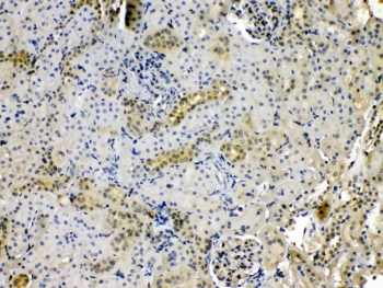 PNP / Nucleoside Phosphorylase Antibody - IHC testing of FFPE rat kidney tissue with Purine nucleoside phosphorylase antibody at 1ug/ml. HIER: steam section in pH6 citrate buffer for 20 min.