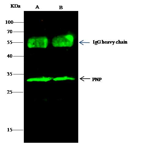 PNP / Nucleoside Phosphorylase Antibody - PNP was immunoprecipitated using: Lane A: 0.5 mg Jurkat Whole Cell Lysate. Lane B: 0.5 mg k562 Whole Cell Lysate. 2 uL anti-PNP rabbit polyclonal antibody and 15 ul of 50% Protein G agarose. Primary antibody: Anti-PNP rabbit polyclonal antibody, at 1:200 dilution. Secondary antibody: Dylight 800-labeled antibody to rabbit IgG (H+L), at 1:5000 dilution. Developed using the odssey technique. Performed under reducing conditions. Predicted band size: 32 kDa. Observed band size: 32 kDa.