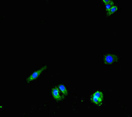 PNPLA1 Antibody - Immunofluorescent analysis of HepG2 cells using PNPLA1 Antibody at dilution of 1:100 and Alexa Fluor 488-congugated AffiniPure Goat Anti-Rabbit IgG(H+L)