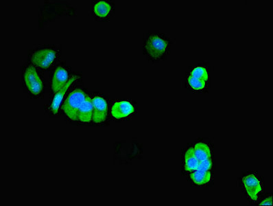 PNPLA1 Antibody - Immunofluorescent analysis of MCF-7 cells using PNPLA1 Antibody at dilution of 1:100 and Alexa Fluor 488-congugated AffiniPure Goat Anti-Rabbit IgG(H+L)
