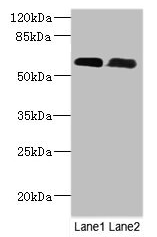 PNPLA1 Antibody - Western Blot All lanes: PNPLA1 antibody at 12µg/ml Lane 1: Mouse spleen tissue Lane 2: Mouse skeletal muscle tissue Secondary Goat polyclonal to rabbit IgG at 1/10000 dilution Predicted band size: 58, 48, 49 kDa Observed band size: 58 kDa