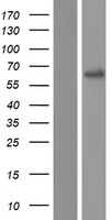 PNPLA1 Protein - Western validation with an anti-DDK antibody * L: Control HEK293 lysate R: Over-expression lysate
