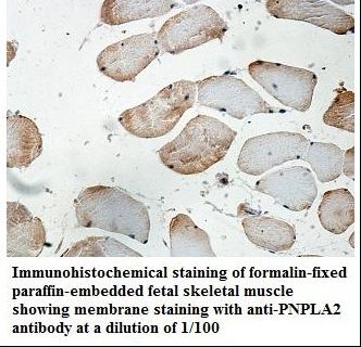 PNPLA2 / ATGL Antibody