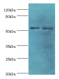 PNPLA2 / ATGL Antibody - Western blot. All lanes: PNPLA2 antibody at 10 ug/ml. Lane 1: 431 whole cell lysate. Lane 2: HeLa whole cell lysate. Secondary antibody: Goat polyclonal to rabbit at 1:10000 dilution. Predicted band size: 55 kDa. Observed band size: 55 kDa.