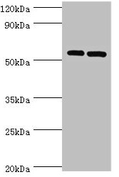 PNPLA2 / ATGL Antibody - Western blot All lanes: PNPLA2 antibody at 10µg/ml Lane 1: A431 whole cell lysate Lane 2: Hela whole cell lysate Secondary Goat polyclonal to rabbit IgG at 1/10000 dilution Predicted band size: 56, 20 kDa Observed band size: 56 kDa