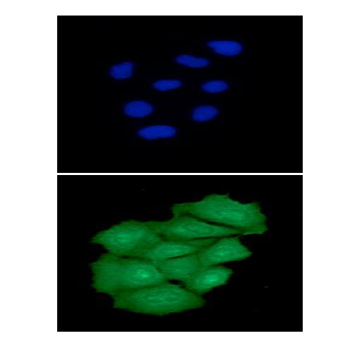 PNPLA2 / ATGL Antibody - ICC/IF analysis of ATGL in Hep3B cells line, stained with DAPI (Blue) for nucleus staining and monoclonal anti-human ATGL antibody (1:100) with goat anti-mouse IgG-Alexa fluor 488 conjugate (Green).ICC/IF analysis of ATGL in HeLa cells line, stained with DAPI (Blue) for nucleus staining and monoclonal anti-human ATGL antibody (1:100) with goat anti-mouse IgG-Alexa fluor 488 conjugate (Green).ICC/IF analysis of ATGL in A549 cells line, stained with DAPI (Blue) for nucleus staining and monoclonal anti-human ATGL antibody (1:100) with goat anti-mouse IgG-Alexa fluor 488 conjugate (Green).