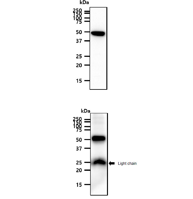 PNPLA2 / ATGL Antibody - The A431 cell lysate (40ug) were resolved by SDS-PAGE, transferred to PVDF membrane and probed with anti-human ATGL antibody (1:1000). Proteins were visualized using a goat anti-mouse secondary antibody conjugated to HRP and an ECL detection system. The mouse adipose tissue lysate (40ug) were resolved by SDS-PAGE, transferred to PVDF membrane and probed with anti-human ATGL antibody (1:1000). Proteins were visualized using a goat anti-mouse secondary antibody conjugated to HRP and an ECL detection system.