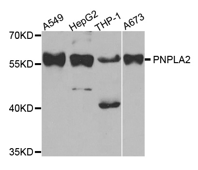 PNPLA2 / ATGL Antibody - Western blot analysis of extracts of various cell lines, using PNPLA2 antibody.