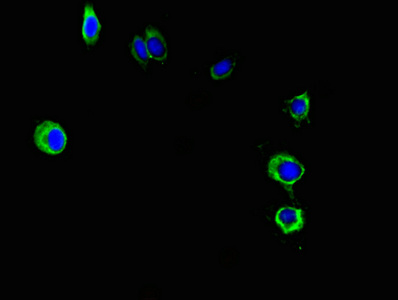PNPLA2 / ATGL Antibody - Immunofluorescent analysis of Hela cells using PNPLA2 Antibody at dilution of 1:100 and Alexa Fluor 488-congugated AffiniPure Goat Anti-Rabbit IgG(H+L)