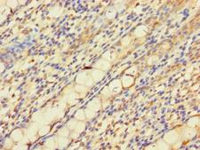 PNPLA2 / ATGL Antibody - Immunohistochemistry of paraffin-embedded human rectum tissue using PNPLA2 Antibody at dilution of 1:100