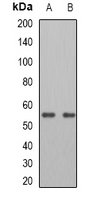 PNPLA2 / ATGL Antibody - Western blot analysis of ATGL expression in A549 (A); HepG2 (B) whole cell lysates.