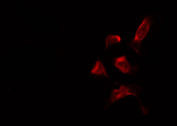 PNPLA2 / ATGL Antibody - Staining HepG2 cells by IF/ICC. The samples were fixed with PFA and permeabilized in 0.1% Triton X-100, then blocked in 10% serum for 45 min at 25°C. The primary antibody was diluted at 1:200 and incubated with the sample for 1 hour at 37°C. An Alexa Fluor 594 conjugated goat anti-rabbit IgG (H+L) Ab, diluted at 1/600, was used as the secondary antibody.