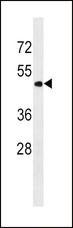 PNPLA3 / Adiponutrin Antibody - PNPLA3 Antibody western blot of K562 cell line lysates (35 ug/lane). The PNPLA3 antibody detected the PNPLA3 protein (arrow).