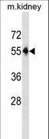 PNPLA3 / Adiponutrin Antibody - Mouse Pnpla3 Antibody western blot of mouse kidney tissue lysates (35 ug/lane). The Pnpla3 antibody detected the Pnpla3 protein (arrow).