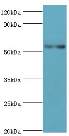 PNPLA3 / Adiponutrin Antibody - Western blot. All lanes: Patatin-like phospholipase domain-containing protein 3 antibody at 8 ug/ml+HepG2 whole cell lysate. Secondary antibody: Goat polyclonal to rabbit at 1:10000 dilution. Predicted band size: 53 kDa. Observed band size: 53 kDa Immunohistochemistry.