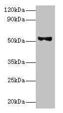 PNPLA3 / Adiponutrin Antibody - Western blot All lanes: Patatin-like phospholipase domain-containing protein 3 antibody at 8µg/ml + HepG2 whole cell lysate Secondary Goat polyclonal to rabbit IgG at 1/10000 dilution Predicted band size: 53 kDa Observed band size: 53 kDa