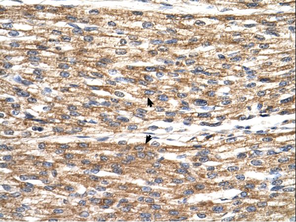 PNPLA3 / Adiponutrin Antibody - PNPLA3 antibody PNPLA3(patatin-like phospholipase domain containing 3) Antibody was used in IHC to stain formalin-fixed, paraffin-embedded human heart.  This image was taken for the unconjugated form of this product. Other forms have not been tested.