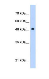 PNPLA3 / Adiponutrin Antibody - Jurkat cell lysate. Antibody concentration: 1.0 ug/ml. Gel concentration: 12%.  This image was taken for the unconjugated form of this product. Other forms have not been tested.