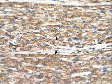 PNPLA3 / Adiponutrin Antibody - PNPLA3 antibody PNPLA3(patatin-like phospholipase domain containing 3) Antibody was used in IHC to stain formalin-fixed, paraffin-embedded human heart.  This image was taken for the unconjugated form of this product. Other forms have not been tested.