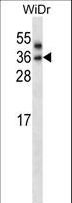 PNPLA4 Antibody - PNPLA4 Antibody western blot of WiDr cell line lysates (35 ug/lane). The PNPLA4 antibody detected the PNPLA4 protein (arrow).