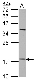 PNPLA4 Antibody - Sample (30 ug of whole cell lysate) A: H1299 12% SDS PAGE PNPLA4 antibody diluted at 1:500