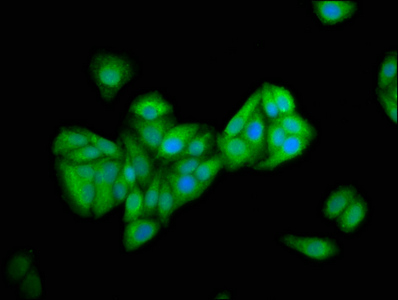 PNPLA5 Antibody - Immunofluorescence staining of HepG2 cells at a dilution of 1:166, counter-stained with DAPI. The cells were fixed in 4% formaldehyde, permeabilized using 0.2% Triton X-100 and blocked in 10% normal Goat Serum. The cells were then incubated with the antibody overnight at 4°C.The secondary antibody was Alexa Fluor 488-congugated AffiniPure Goat Anti-Rabbit IgG (H+L) .