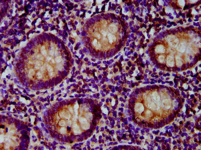 PNPLA5 Antibody - Immunohistochemistry image at a dilution of 1:500 and staining in paraffin-embedded human appendix tissue performed on a Leica BondTM system. After dewaxing and hydration, antigen retrieval was mediated by high pressure in a citrate buffer (pH 6.0) . Section was blocked with 10% normal goat serum 30min at RT. Then primary antibody (1% BSA) was incubated at 4 °C overnight. The primary is detected by a biotinylated secondary antibody and visualized using an HRP conjugated SP system.