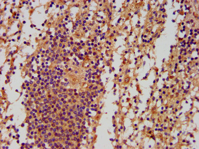 PNPLA5 Antibody - Immunohistochemistry image at a dilution of 1:500 and staining in paraffin-embedded human spleen tissue performed on a Leica BondTM system. After dewaxing and hydration, antigen retrieval was mediated by high pressure in a citrate buffer (pH 6.0) . Section was blocked with 10% normal goat serum 30min at RT. Then primary antibody (1% BSA) was incubated at 4 °C overnight. The primary is detected by a biotinylated secondary antibody and visualized using an HRP conjugated SP system.