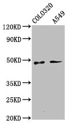 PNPLA5 Antibody - Positive Western Blot detected in COLO320 whole cell lysate, A549 whole cell lysate. All lanes: PNPLA5 antibody at 3.1 µg/ml Secondary Goat polyclonal to rabbit IgG at 1/50000 dilution. Predicted band size: 48, 36 KDa. Observed band size: 48 KDa