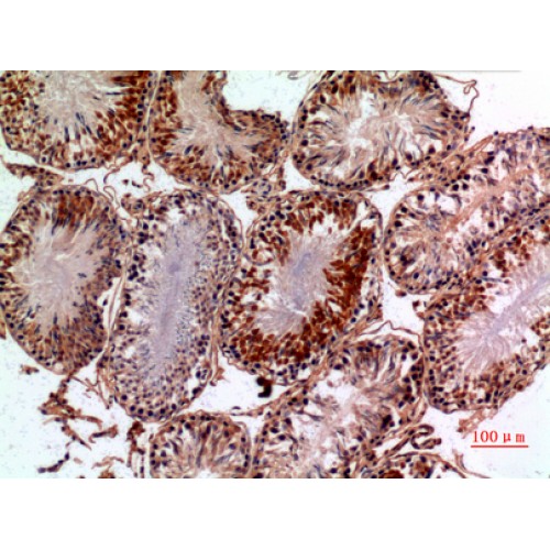 PNPLA6 / NTE Antibody - Immunohistochemistry of NTE antibody