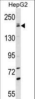 PNPLA6 / NTE Antibody - PNPLA6 Antibody western blot of HepG2 cell line lysates (35 ug/lane). The PNPLA6 antibody detected the PNPLA6 protein (arrow).