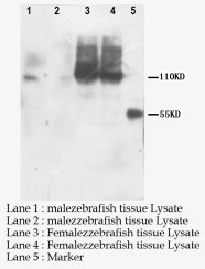 PNPLA6 / NTE Antibody -  This image was taken for the unconjugated form of this product. Other forms have not been tested.
