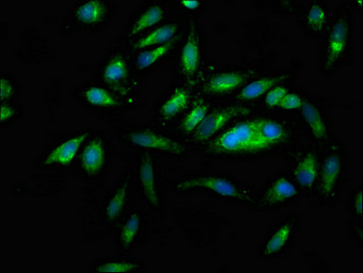 PNPLA6 / NTE Antibody - Immunofluorescence staining of Hela cells at a dilution of 1:166, counter-stained with DAPI. The cells were fixed in 4% formaldehyde, permeabilized using 0.2% Triton X-100 and blocked in 10% normal Goat Serum. The cells were then incubated with the antibody overnight at 4 °C.The secondary antibody was Alexa Fluor 488-congugated AffiniPure Goat Anti-Rabbit IgG (H+L) .