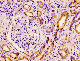 PNPLA6 / NTE Antibody - Immunohistochemistry image at a dilution of 1:500 and staining in paraffin-embedded human kidney tissue performed on a Leica BondTM system. After dewaxing and hydration, antigen retrieval was mediated by high pressure in a citrate buffer (pH 6.0) . Section was blocked with 10% normal goat serum 30min at RT. Then primary antibody (1% BSA) was incubated at 4 °C overnight. The primary is detected by a biotinylated secondary antibody and visualized using an HRP conjugated SP system.