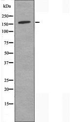 PNPLA6 / NTE Antibody - Western blot analysis of extracts of COLO205 cells using PNPLA6 antibody.