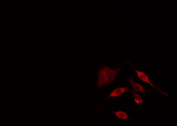 PNPLA6 / NTE Antibody - Staining COLO205 cells by IF/ICC. The samples were fixed with PFA and permeabilized in 0.1% Triton X-100, then blocked in 10% serum for 45 min at 25°C. The primary antibody was diluted at 1:200 and incubated with the sample for 1 hour at 37°C. An Alexa Fluor 594 conjugated goat anti-rabbit IgG (H+L) antibody, diluted at 1/600, was used as secondary antibody.