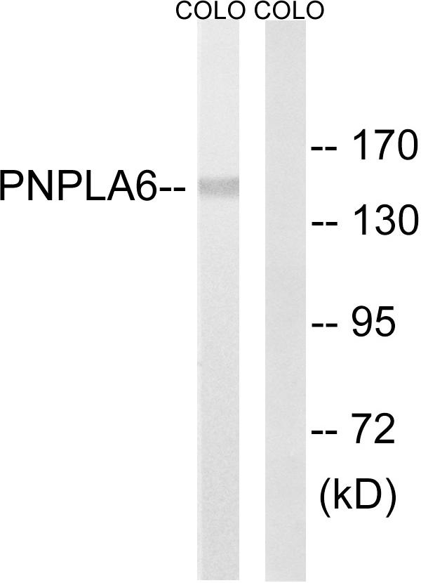 PNPLA6 / NTE Antibody - Western blot analysis of extracts from COLO205 cells, using PNPLA6 antibody.