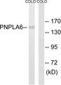 PNPLA6 / NTE Antibody - Western blot analysis of extracts from COLO205 cells, using PNPLA6 antibody.